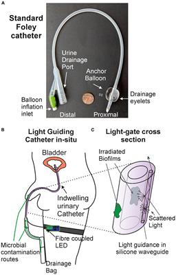 A light-guiding <mark class="highlighted">urinary catheter</mark> for the inhibition of Proteus mirabilis biofilm formation